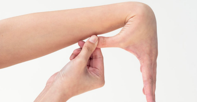 Ehlers-Danlos Syndrome (EDS) Physiotherapy in Stittsville